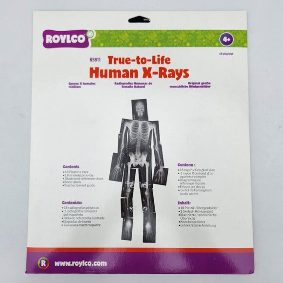 NEW Roylco True-to Life Human X-Rays - Age 4+ R5911 XRays Nancy Larson School Su - Picture 1 of 6